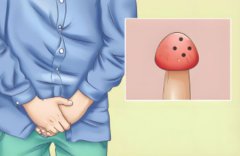 龟 头上长了黑斑是怎么回事