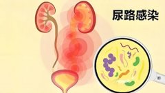 尿路感染的症状有哪些表现