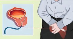 男人前列腺炎能同房吗