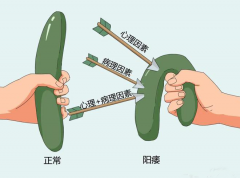 感觉是阳痿怎么办？建议做下这个检查