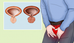 如何给男性前列腺“温暖”守护