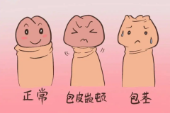 包皮手术后如何护理促恢复