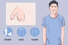 做完包皮手术后需要注意什么