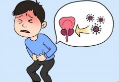 前列腺增生有哪些早期症状